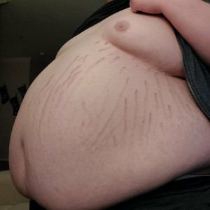 apollochub #8608503