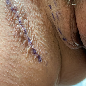 mizxtrix #1307447