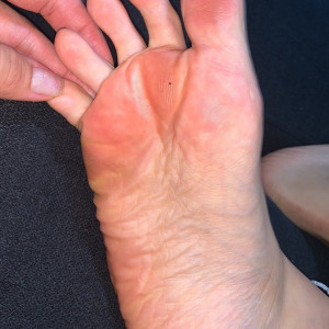 amberskyetoesies #7085477