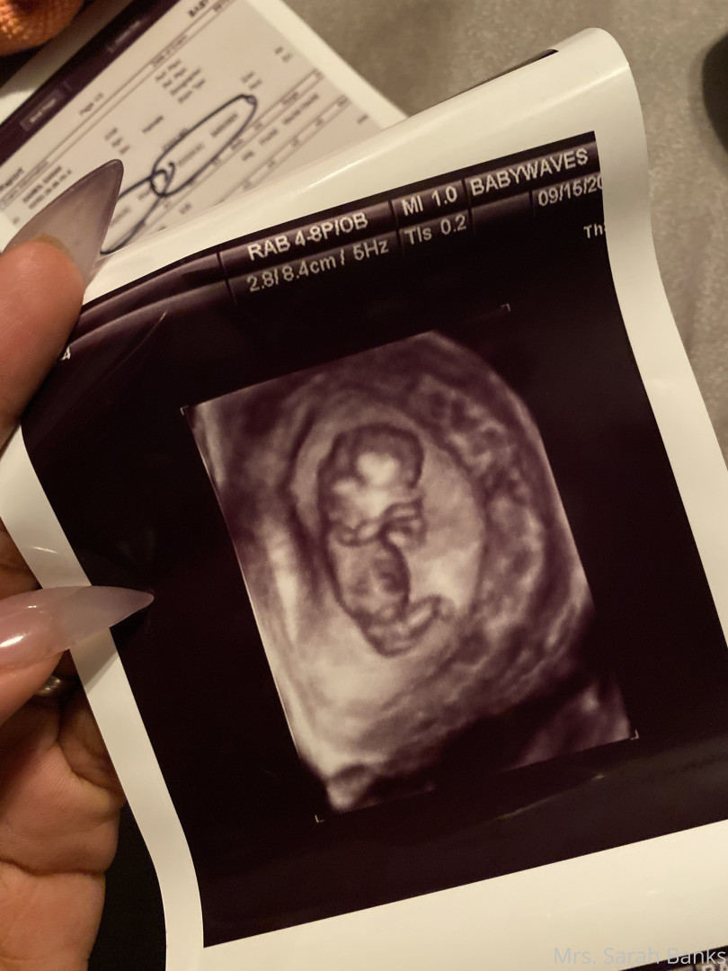 Photo by thesarahbnkx published on July 29,2023 11:30:13 - BestThots