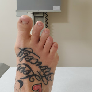 lovefiercelyfeet #1898458
