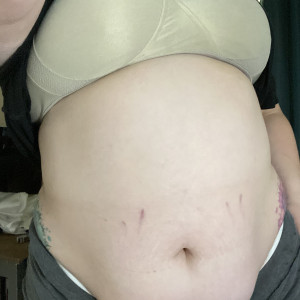 tummygrow #6263456