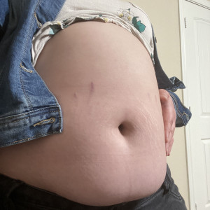 tummygrow #6263766