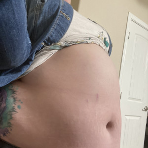 tummygrow #6264428