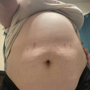 tummygrow #6265998