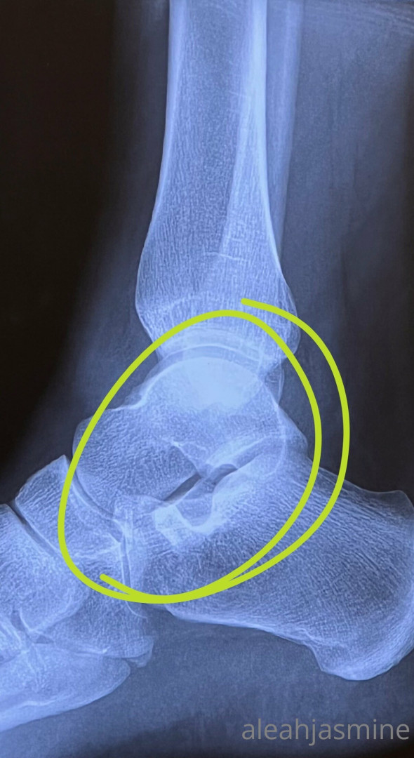 Photo by aleahjasmine published on November 19,2023 17:48:22 - BestThots