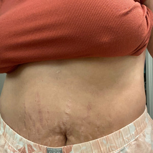 alt_toe_ego #8322193