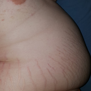 fatterigrow #7906924