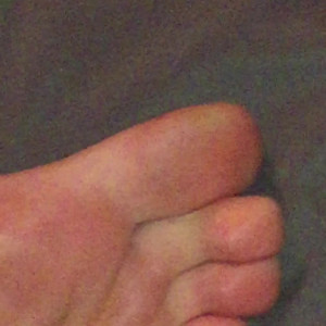 freckled_feet #5304375
