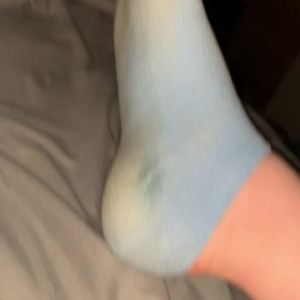 freckled_feet #5642461