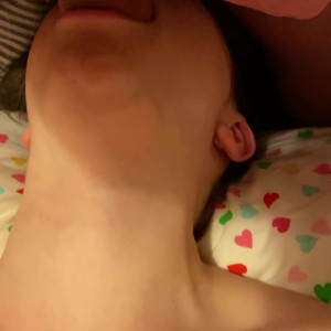 kinkyemma #5329142