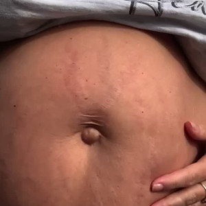 prettypregnant35 #5422148