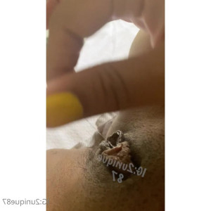 twounique87 #5031258