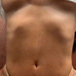 lenspecimen #3755417