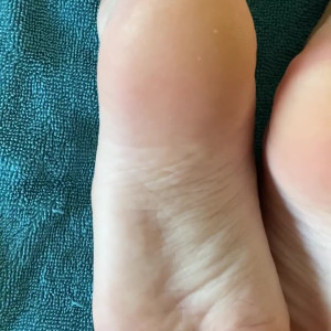 myposedtoesvip #3211199