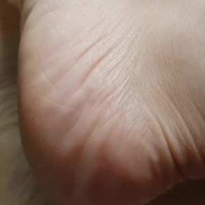 feetbraga #4308828