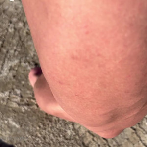 nataliakovalevafbb #5352673