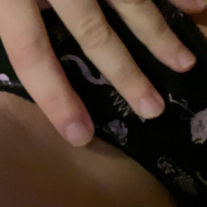 yungtripleg #3695302