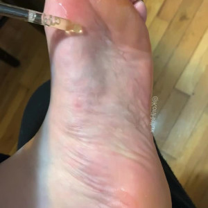 kori_hallux #4181160