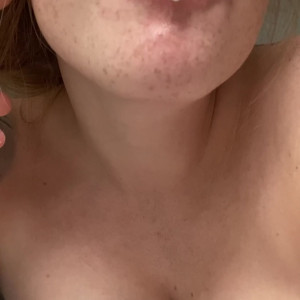 Video by gingerlovesanal published on March 17,2023 21:06:00 - BestThots