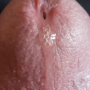 precumtherapy #4729371