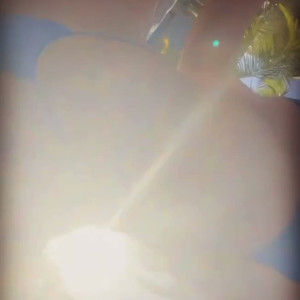 Video by lupuwellness published on August 17,2023 07:34:41 - BestThots