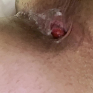 tsnikkiedickie #4079437