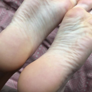 kissabletoess #4013583